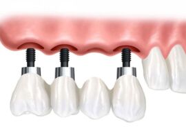 thessaloniki odontiatroi