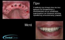 thessaloniki odontiatroi