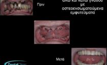 thessaloniki odontiatroi