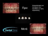 thessaloniki-odontiatroi