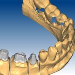 thessaloniki odontiatroi