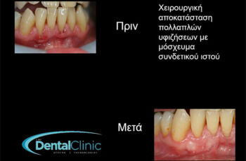 hessaloniki-odontiatroi