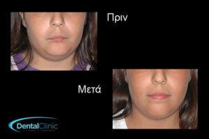 thessaloniki odontiatroi